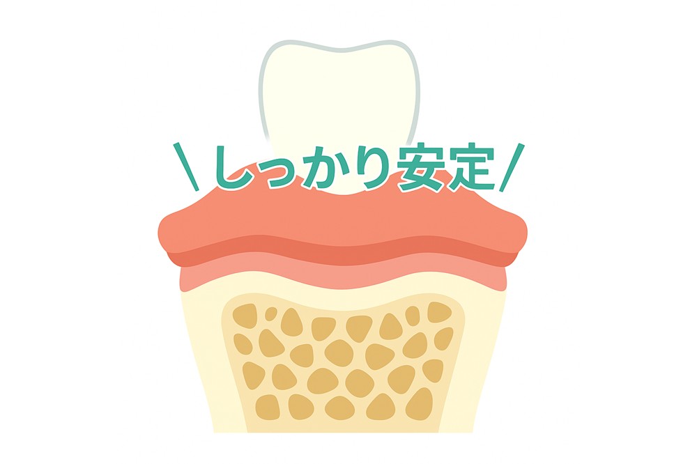 お口の中でがっちり固定。安定して外れにくい