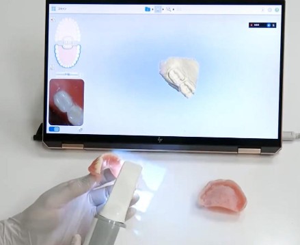 外科手術不要。オーダーメイドのやわらかいクッション