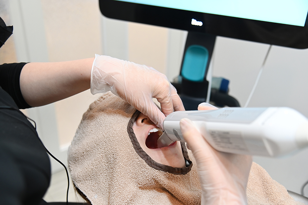 スキャン（型取り）