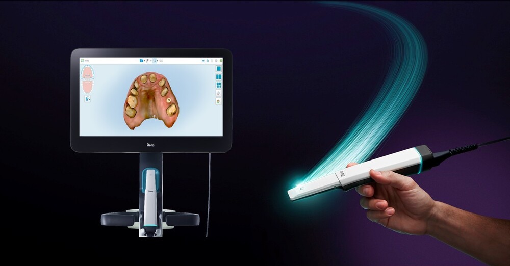 デジタルを使用した治療シミュレーション